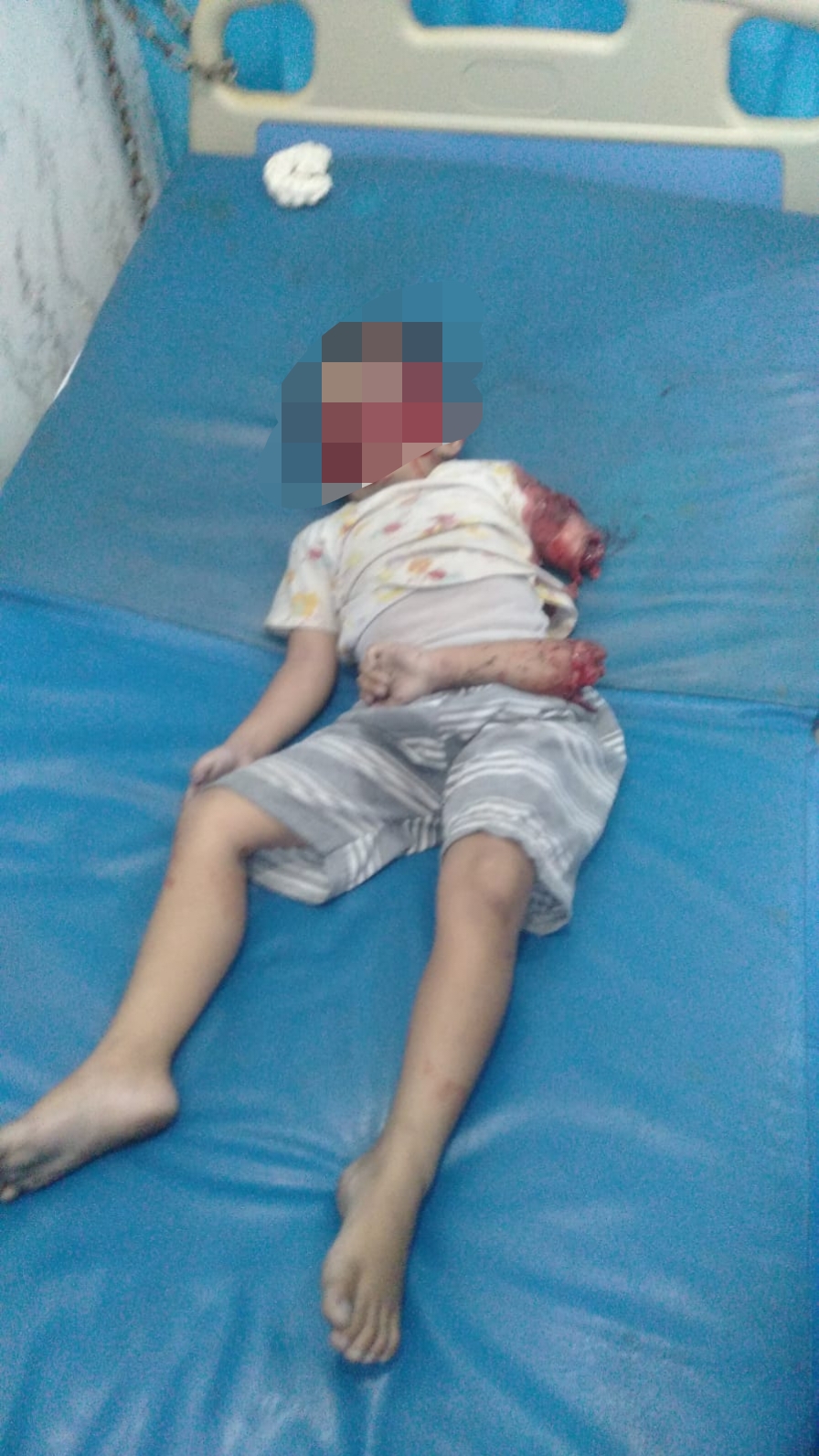 Kecelakaan Lalu Lintas di Jl. Poros Panciro Desa Panciro Kec. Bajeng Kab. Gowa