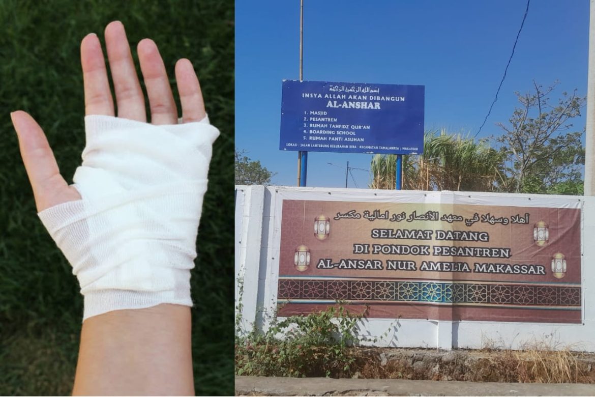 Pembina Ponpes Al-Ansar Nur Amelia Diduga Lambat Tangani Santri Terluka