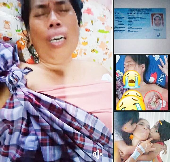 Wanita Penderita Kanker Payudara Stadium 4 butuh Uluran Tangan