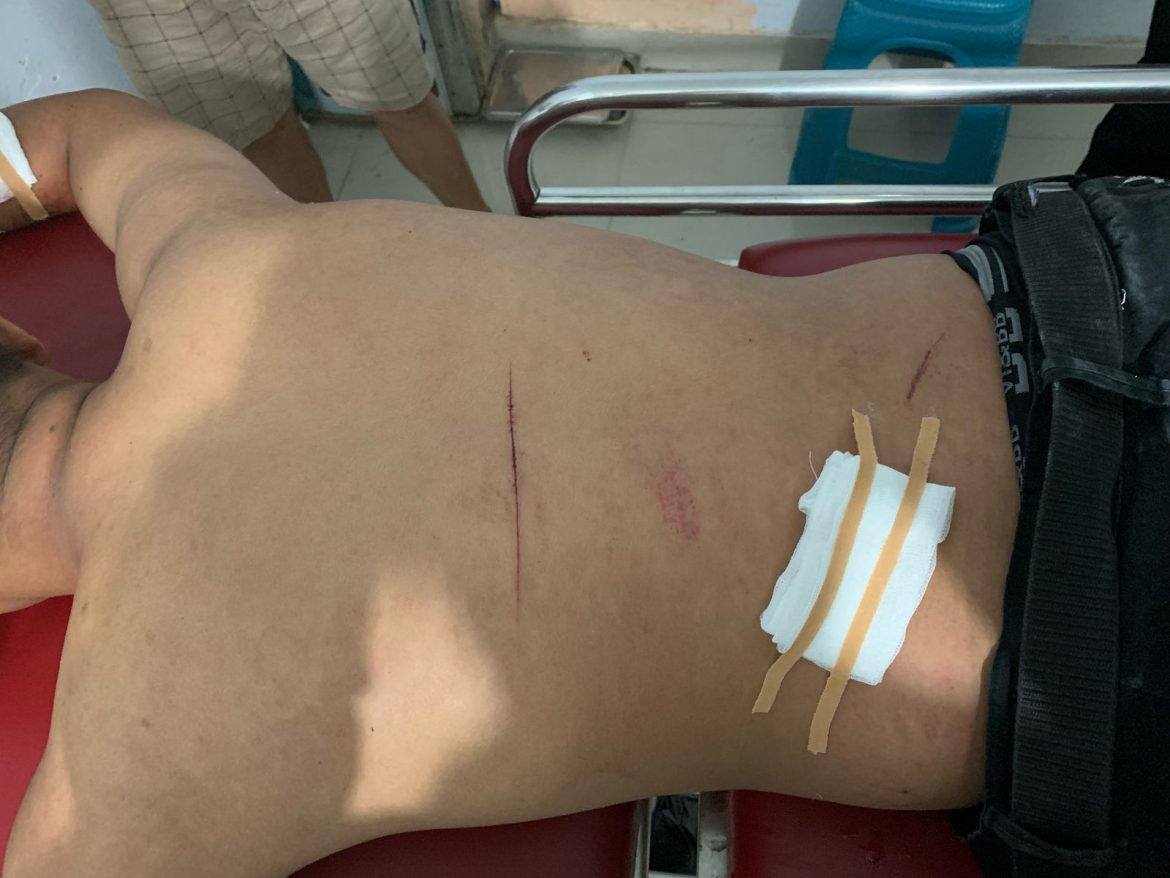 Pemuda Ditikam OTK di Polewali, Tiga HP Raib
