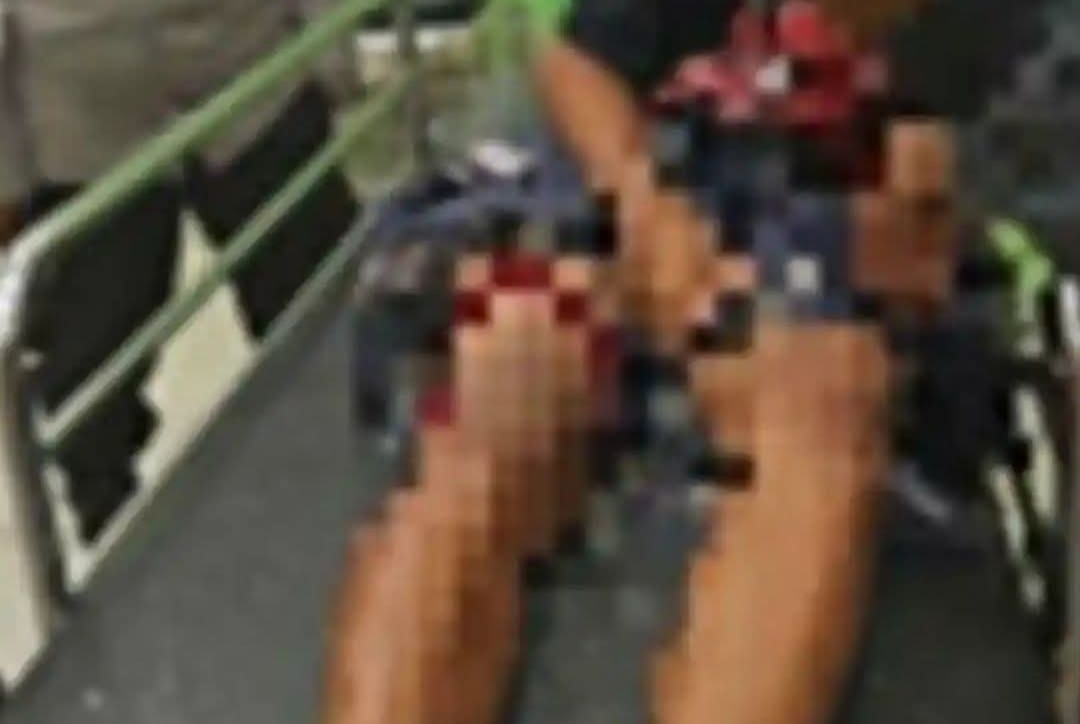 Remaja 14 Tahun Ditusuk OTK di Wonomulyo, Penegakan Hukum Diminta Tegas dan Adil